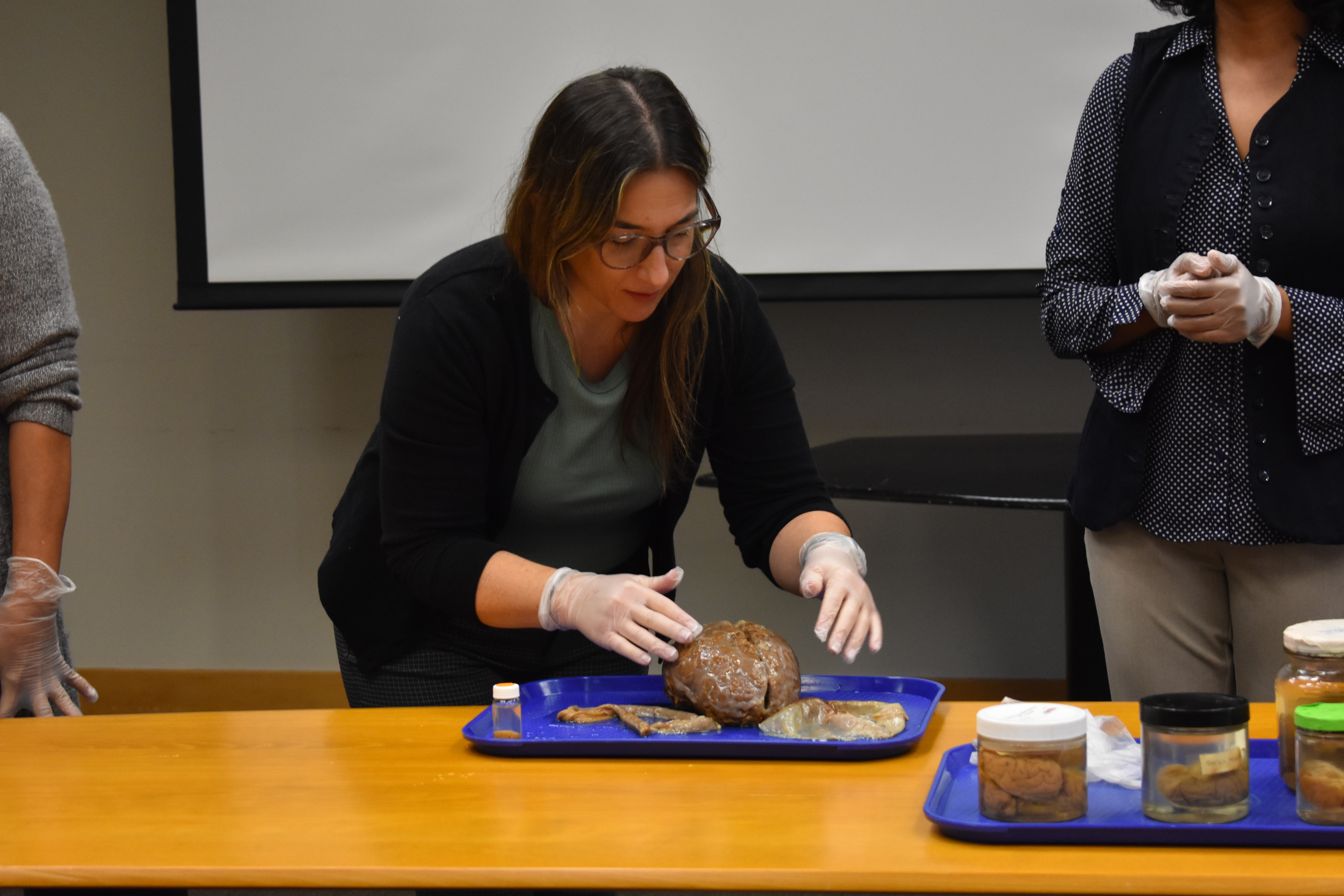 Brain dissection hands-on activity